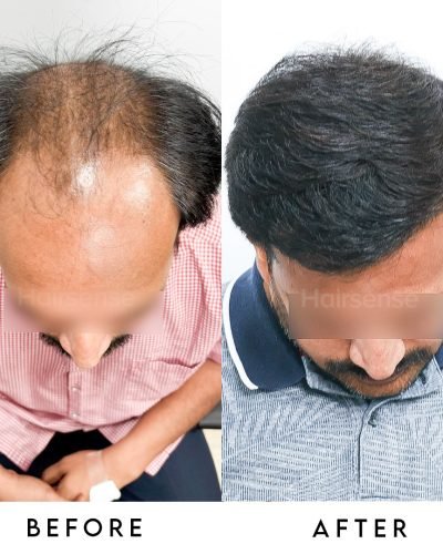 Confidence Restored. ✅From thinning to thriving. Swipe left to view the complete coverage and na (1)