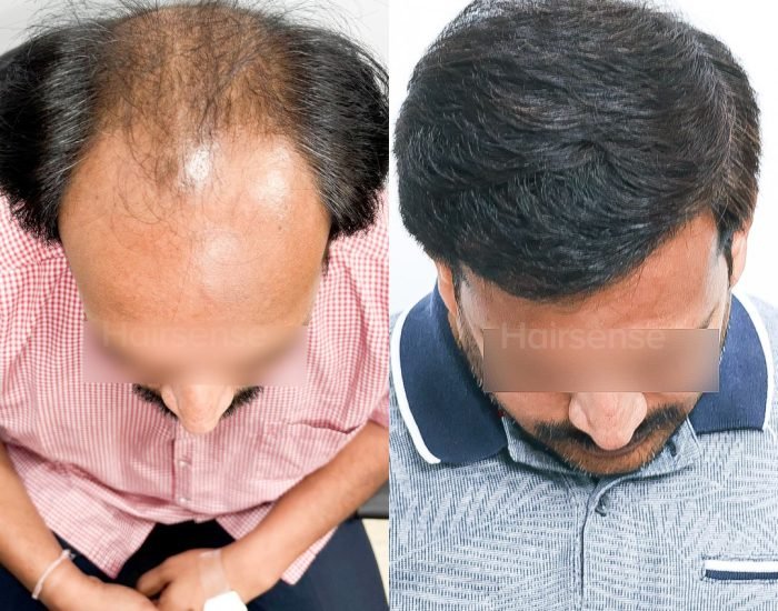 Confidence Restored. ✅From thinning to thriving. Swipe left to view the complete coverage and na (1)