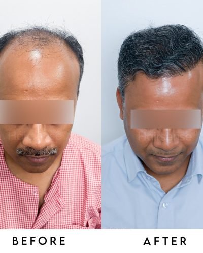 It’s not just about hair; it’s about getting your confidence back.Swipe to see this incredible t (1)