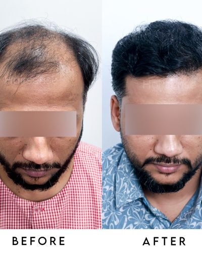 Stop scrolling and start growing! 🌱 Why settle for a receding hairline when you can have a perm (1)