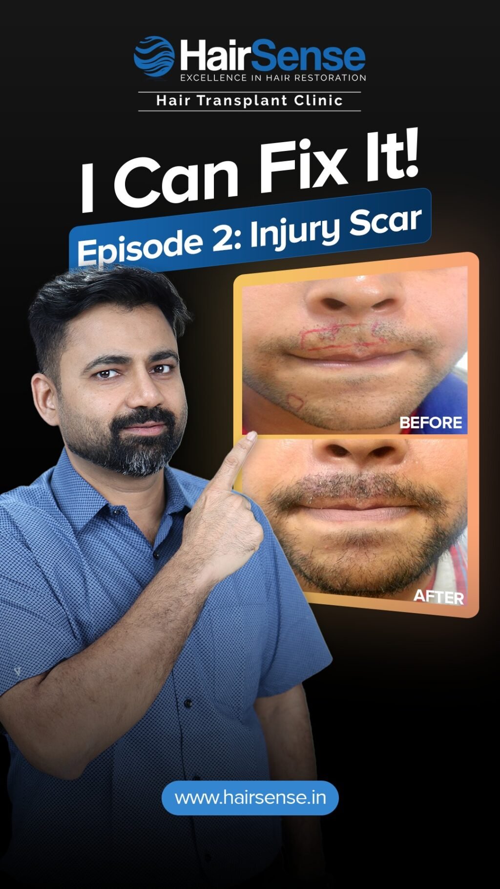 Instagram post from hairsense_hairtransplantclinic. This post is in position 1.