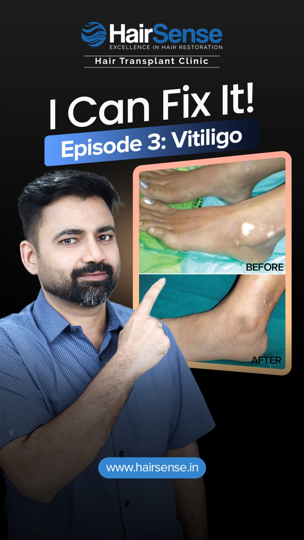 Instagram post from hairsense_hairtransplantclinic. This post is in position 0.