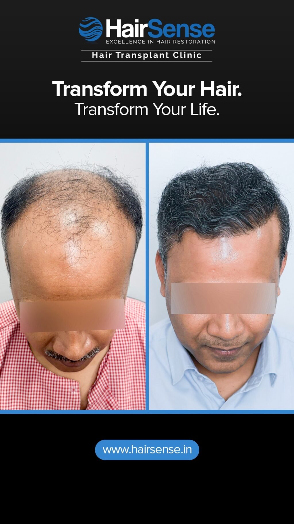 Instagram post from hairsense_hairtransplantclinic. This post is in position 7.