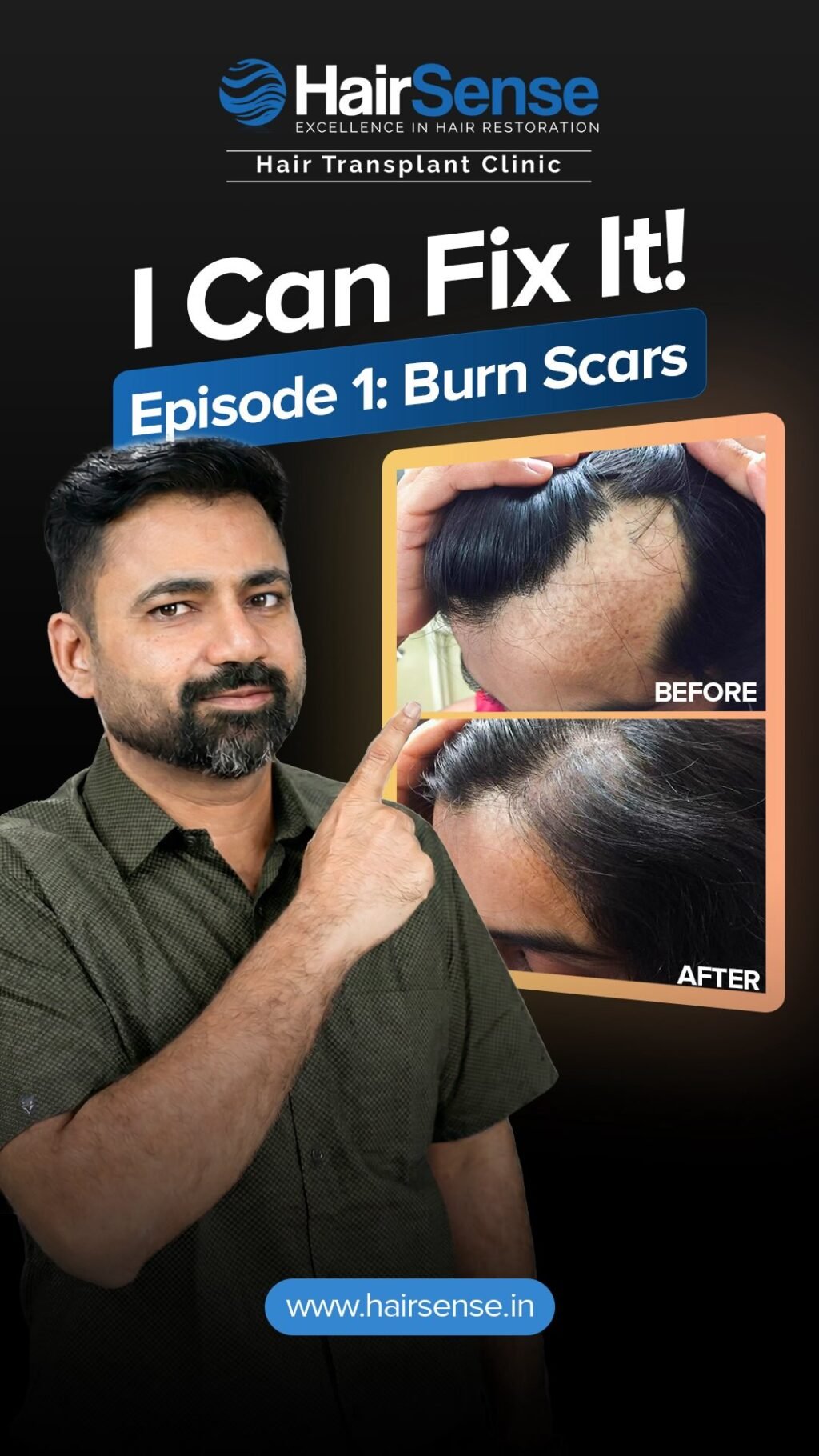 Instagram post from hairsense_hairtransplantclinic. This post is in position 3.